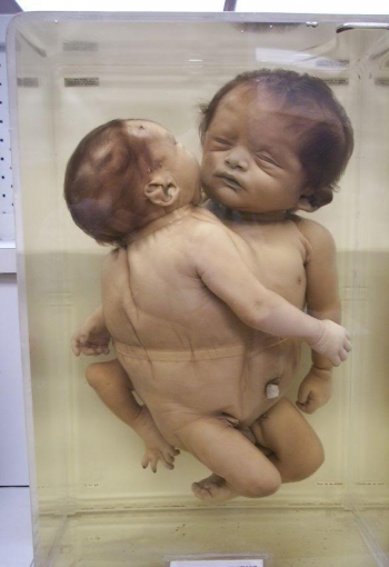 18. bébé nagasaki 2.jpg